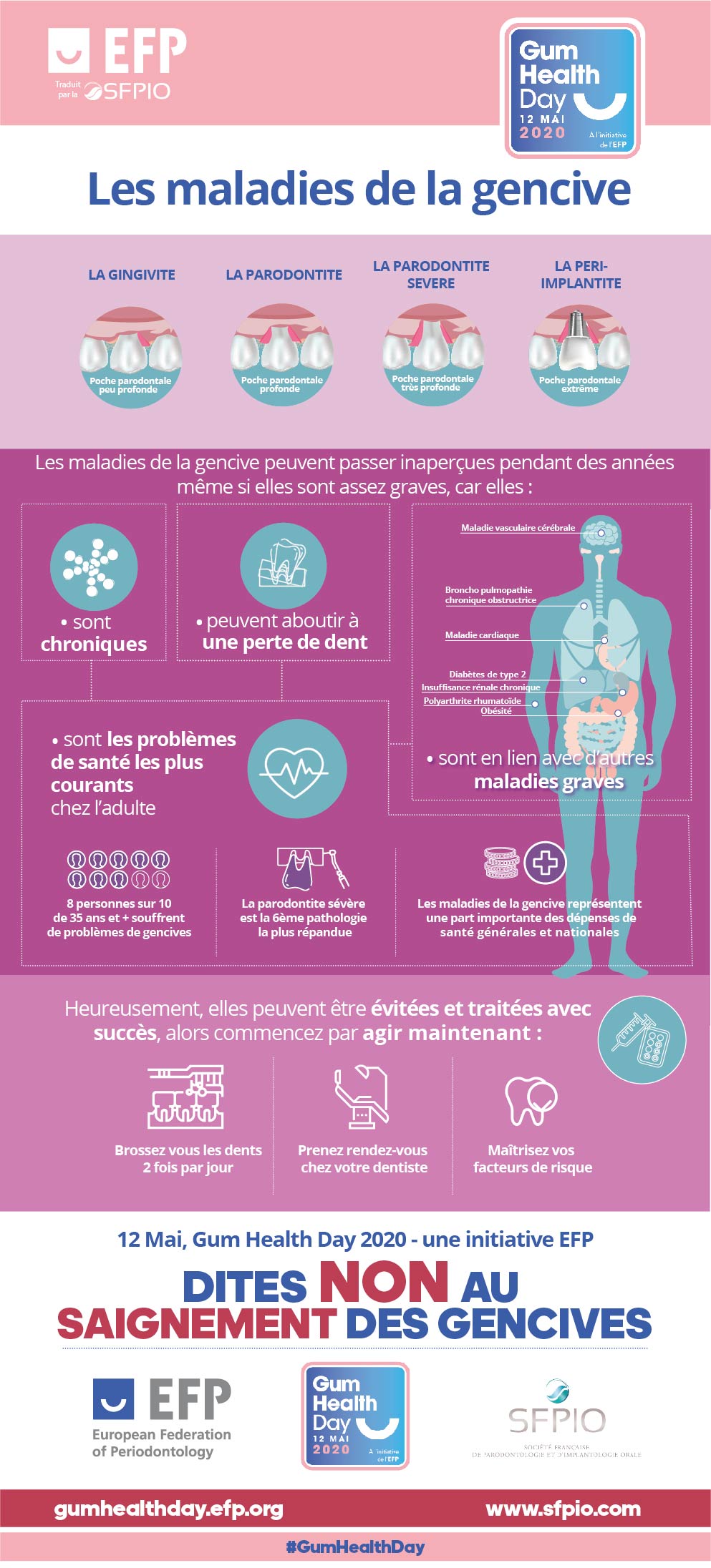 GHD20 GumDiseases Fr